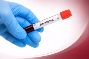 Beta hCG Test