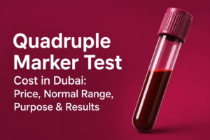 Quadruple Marker Test