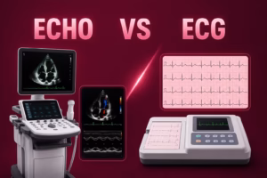 Echo vs ECG