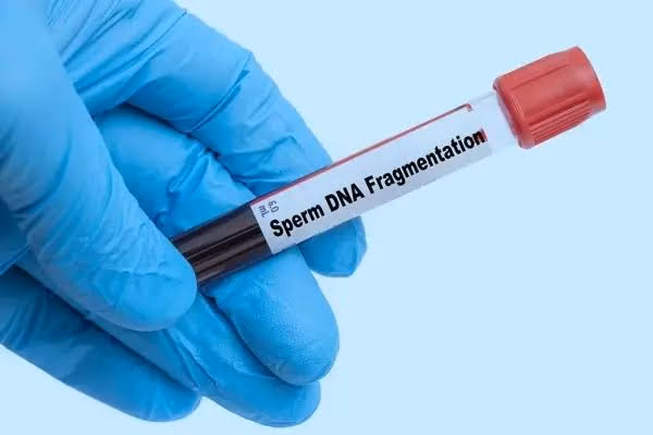 Sperm DNA Fragmentation Test: Cost, Normal Range, Results & Importance for Fertility